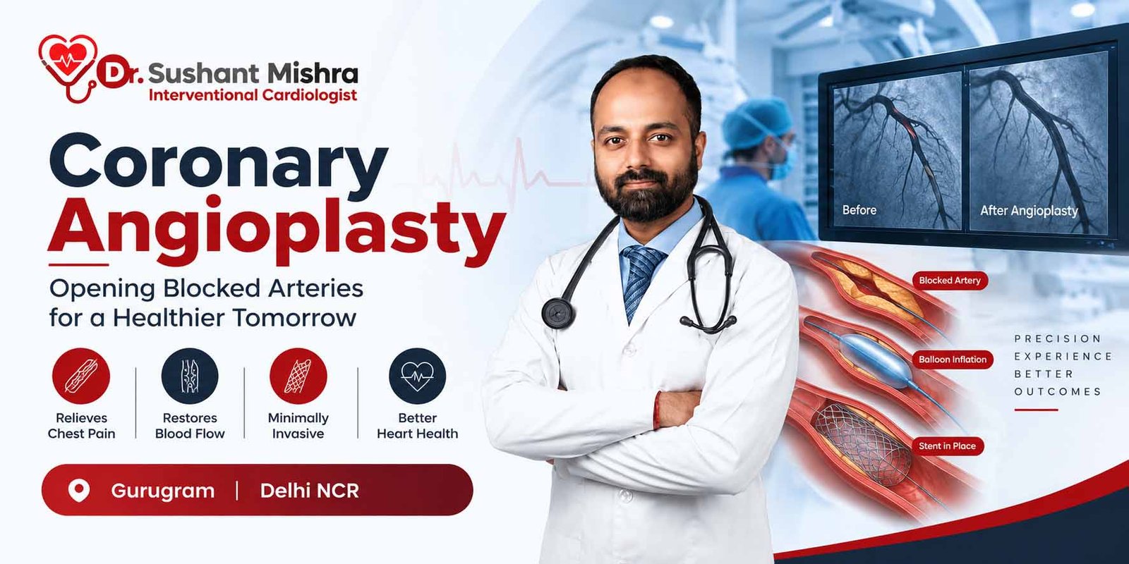 Coronary Angioplasty in Gurugram